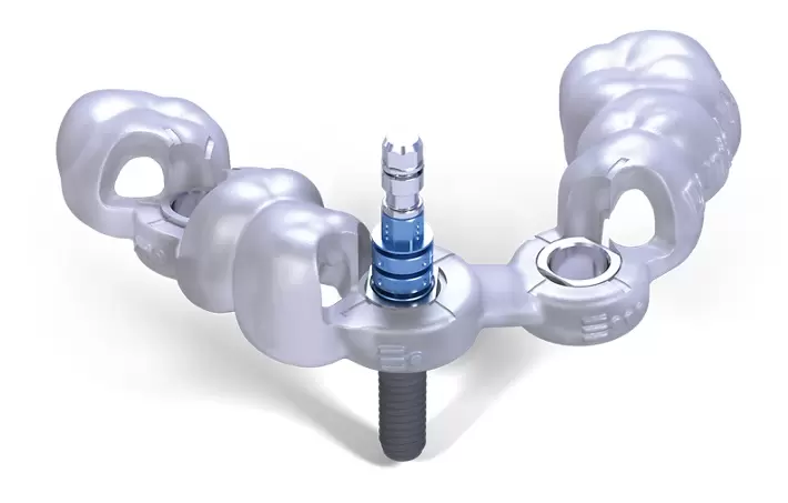 Máng hướng dẫn phẫu thuật Guideline.